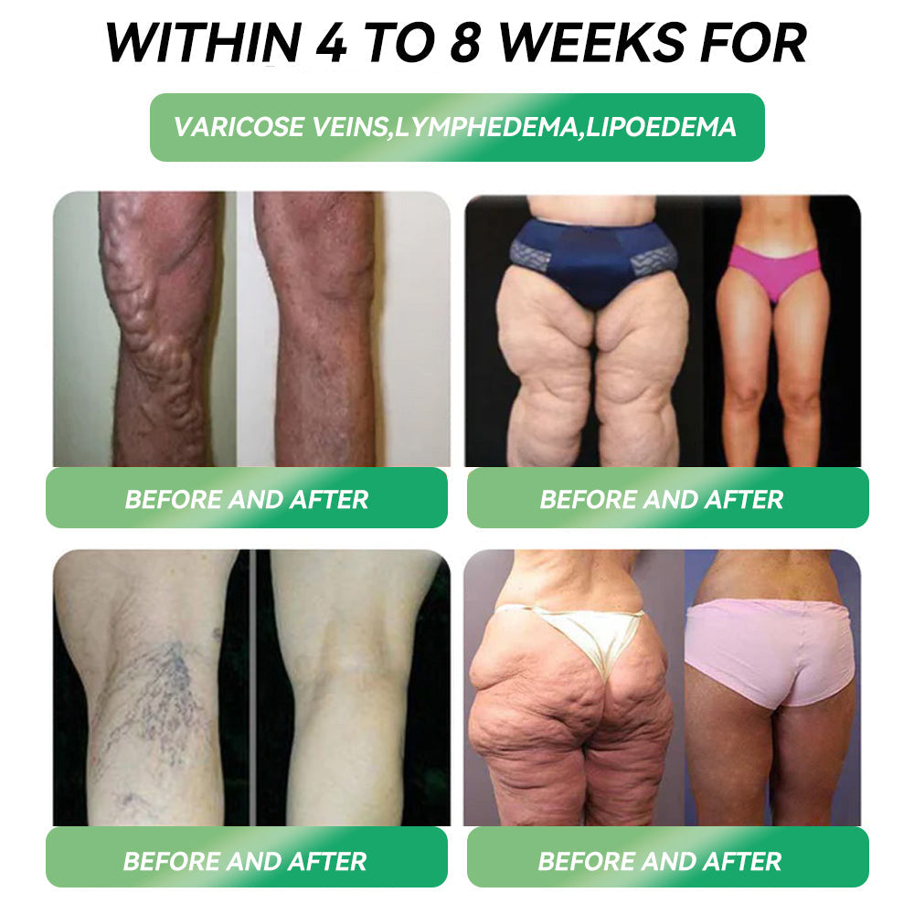 NHS 🇬🇧 Official flagship store Croaie® GLP-1 weight loss oral solution, solving problems such as obesity, cardiovascular disease, and diabetes