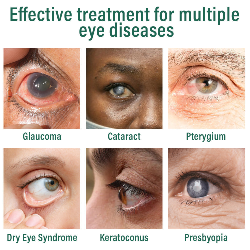 👩⚕️Croaie® Nano Eye Drops Serum ✅MHRA Approved(Suitable for presbyopia, dry eye syndrome, glaucoma, and cataracts)❗️