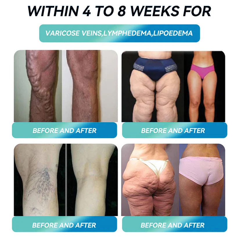 Official Store 🇬🇧 | Croaie® GLP-1 Fat Burning Gummies (Just one daily, see results in 7 days) for losing body fat, cardiovascular health, diabetes, sleep apnea, gut health, joint problems, and more.