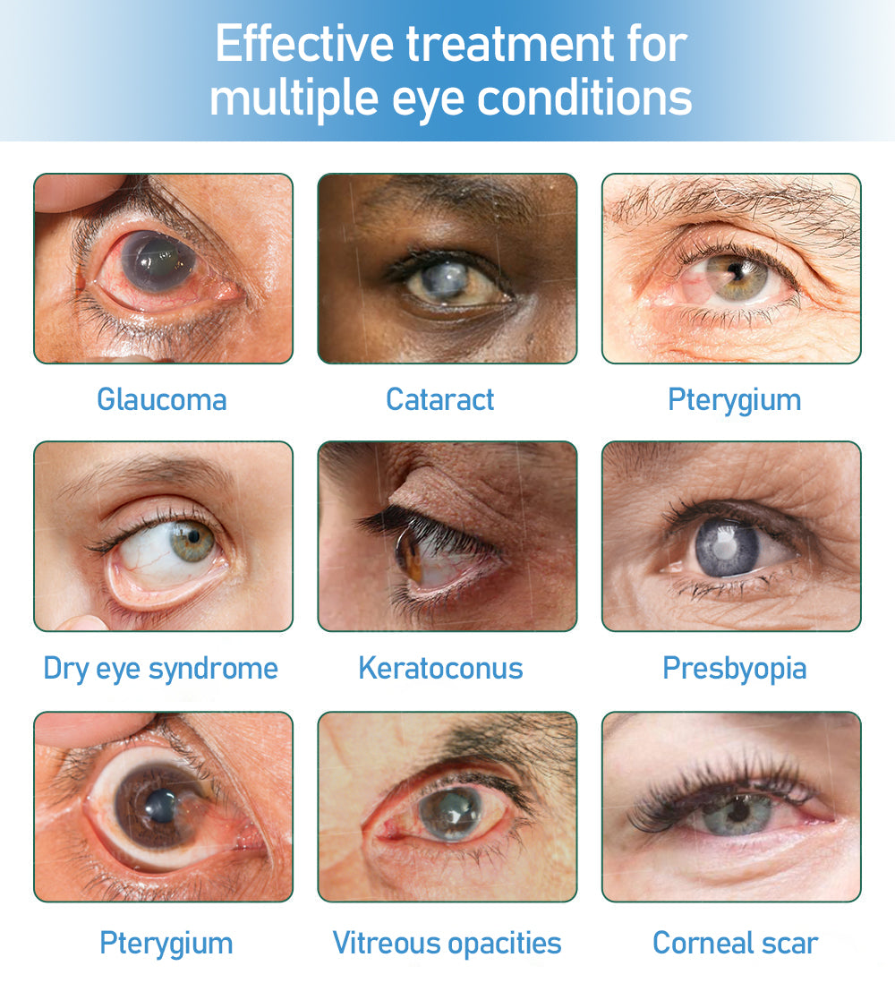 👩⚕️Croaie® Supramolecular Eye Drops ✅ Approved by the MHRA (suitable for cataracts, presbyopia, dry eyes and age-related macular degeneration)